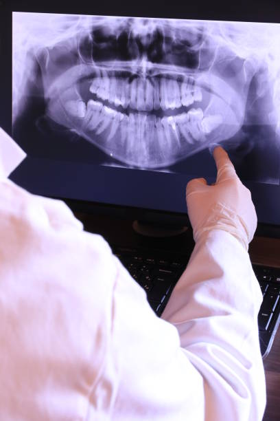 Best Broken or Chipped Tooth Repair in Ripley, OH
