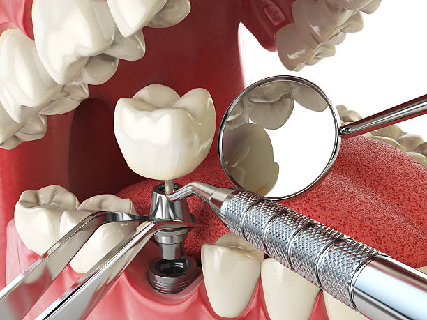 Best Emergency Denture Repair in Ripley, OH